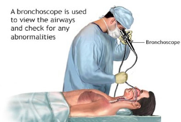 Videobronchoscopy