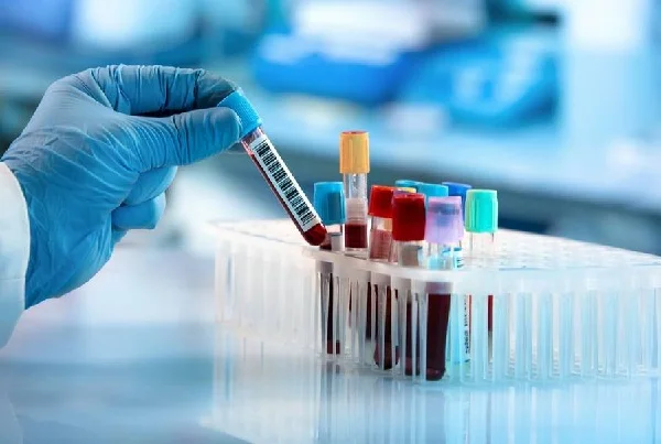 Blood test for Allergy